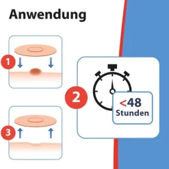 Acetocaustin Warzenpflaster| Online