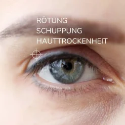 ALLERGIKA® Augenlidcreme MED| Clearance