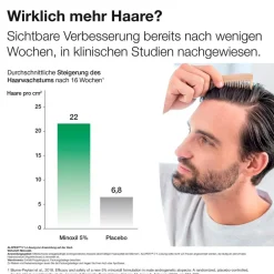 5% Lösung zur Anwendung auf der Haut 3X60 ml gegen anlagebedingten Haarausfall|Alopexy Best