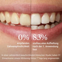 ALPINE WHITE Sensitive Whitening Strips| Clearance