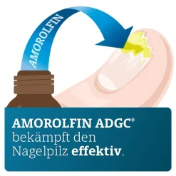 ADGC® wirkstoffhaltiger Nagellack gegen Nagelpilz inkl. Set>Amorolfin Online