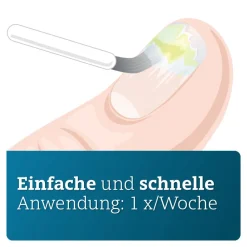 ADGC® wirkstoffhaltiger Nagellack gegen Nagelpilz inkl. Set><noscript><img width=