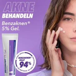 ® 5% Gel>Benzaknen Hot