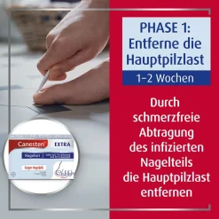 ® EXTRA 2-Phasen-Kurztherapie-Set bei Nagelpilz><noscript><img width=