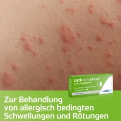 axicur®|Cetirizin