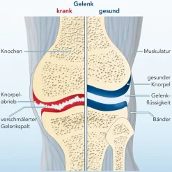 PLUS Gelenk Kollagen Trinkampullen für gesunde Gelenke und Knorpel mit Hagebuttenextrakt und Vitamin C|CH-Alpha Sale