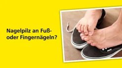 Ciclocutan® 80 mg/g wirkstoffhaltiger Nagellack|