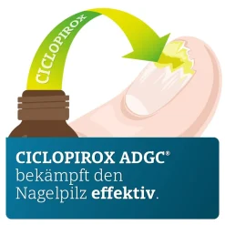 CICLOPIROX ADGC® wirkstoffhaltiger Nagellack gegen Nagelpilz inkl. Set| Hot