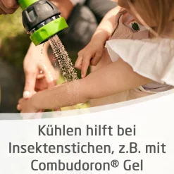 Combudoron® Gel kühlt & lindert Schmerzen bei Insektenstichen, Sonnenbrand & leichten Verbrennungen><noscript><img width=