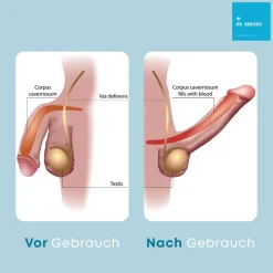 ® Male Formula – Natürliches Potenzmittel für Männer – Alternative zu Viagra und Kamagra><noscript><img width=