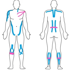 Effekt Manufaktur Kinesiologie Tape – 500 x 5 cm – in blau und pink - Kinesiotape - MEDIZINPRODUKT| Best