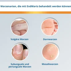 CLASSIC: Lösung mit Ameisensäure gegen Warzen und Dornwarzen, Warzenbehandlung für Hände und Füße|EndWarts Best