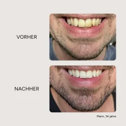 Etinour Essential Whitening & Remineralisierungskit> Sale