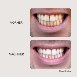 Etinour Essential Whitening & Remineralisierungskit><noscript><img width=