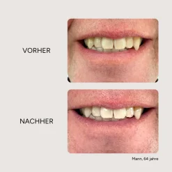 Etinour Essential Whitening & Remineralisierungskit><noscript><img width=