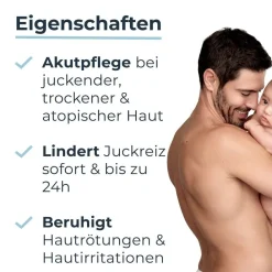 ® AtopiControl Akutpflege Creme hilft wirksam bei akuten Neurodermitisschüben, gegen Juckreiz, Hautrötungen und Entzündungen - Jetzt 20 % mit dem Code 20 sparen><noscript><img width=