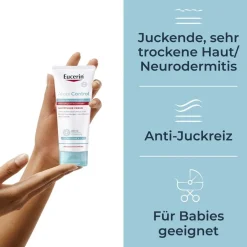 ® AtopiControl Akutpflege Creme hilft wirksam bei akuten Neurodermitisschüben, gegen Juckreiz, Hautrötungen und Entzündungen - Jetzt 20 % mit dem Code 20 sparen><noscript><img width=