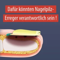 ® Anti-Nagelpilz Liquid - Nagelpilz Nagellack für Füsse und Hände - Wissenschaftlich bestätigte Wirkweise><noscript><img width=