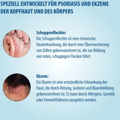 Evolsin® Ekzem & Psoriasis Shampoo bei Schuppenflechte, Ekzemen & Neurodermitis auf Kopfhaut & Körper I OHNE KORTISON I Medizinprodukt I Bei Neurodermitis & Schuppenflechte Kopfhaut|
