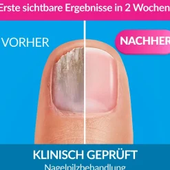 excilor® Lösung gegen Nagelpilz| Hot