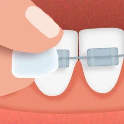 GUM® Ortho Wachs Mint| Hot