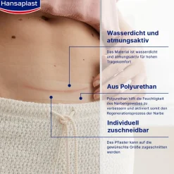 Narben Reduktion XL | Pflaster für Narben | Wasserfeste Narbenpflaster | 21 Stk. - Jetzt 20% mit dem Code hp20 sparen><noscript><img width=