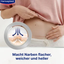 Narben Reduktion XL | Pflaster für Narben | Wasserfeste Narbenpflaster | 21 Stk. - Jetzt 20% mit dem Code hp20 sparen><noscript><img width=