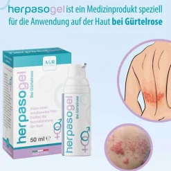 Herpasogel bei Gürtelrose | Fördert die Normalisierung der Haut bei Herpes zoster> Hot