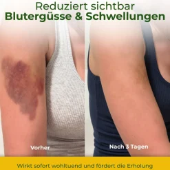 H4H Naturals® Arnika Salbe & Pferdesalbe Gel Linderung bei Knie, Gelenk, Nacken & Muskel><noscript><img width=
