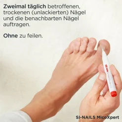 SI-NAILS® MicoXpert gegen Nagelpilz><noscript><img width=