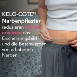 ® Silikon-Narbenpflaster Kaiserschnitt>KELO-COTE New