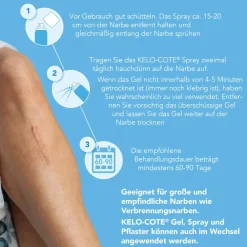 ® Spray|KELO-COTE Best