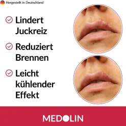 Medolin® Herpesgel - Herpescreme gegen Lippenherpes - Herpes Creme für gesunde Lippen| New