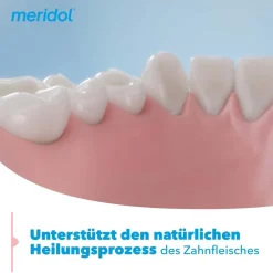 Parodont Expert Zahnpasta bei Parodontitis und Zahnfleischrückgang|Meridol Discount