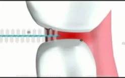 Pic-Brush® Ersatz-Interdentalbürsten gelb x-fine 1,8 mm|Miradent Sale