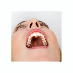 Myospots><noscript><img width=