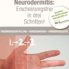 Neurodermitis: Erscheinungsfrei in drei Schritten!>