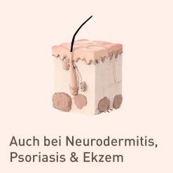 nupure probaderm - Intensive Pflege bei herabgesetzter Hautschutzfunktion| New