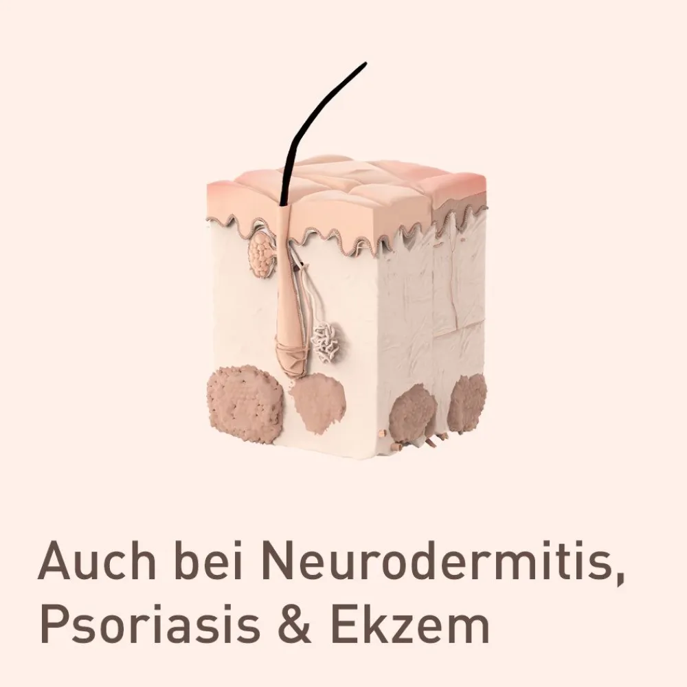nupure probaderm - Intensive Pflege bei herabgesetzter Hautschutzfunktion| New