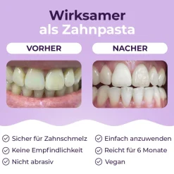 Onlysmile® Coffee Lover Bundle – Zahnpulver & 2x WhiteSilver Zahnpasta gegen Verfärbungen| Discount