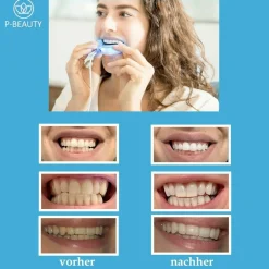 Zahnaufhellungs Set Bleichsystem weiße Zähne><noscript><img width=