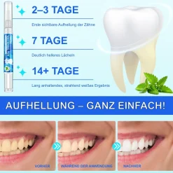 Zahnaufhellung Zahngel Zahnweiß Stift für Weiße Zähne><noscript><img width=