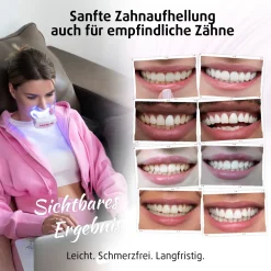 PearlSmile Zahnaufhellungsset für zwei| Clearance