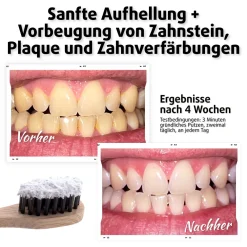 PearlSmile Zahnaufhellungspulver ohne Fluorid|