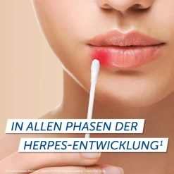 Pencivir bei Lippenherpes Penciclovir 10mg/g Creme| Best