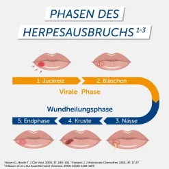 Pencivir bei Lippenherpes Penciclovir 10mg/g Creme| Best