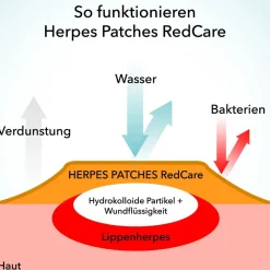Herpes Patches|Redcare Online