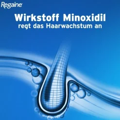 Regaine Männer Lösung mit Minoxidil bei erblich bedingtem Haarausfall><noscript><img width=