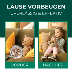 SILBEKRAFT Läusespray>SILBERKRAFT