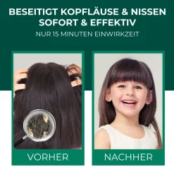 Läuseshampoo>SILBERKRAFT Outlet